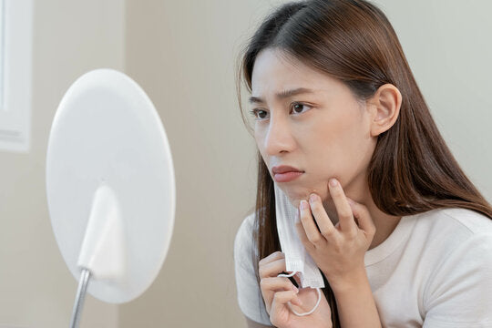 Why Heaven's Heart Lemon Soap is Best for your Pimples