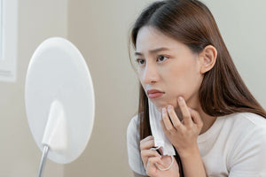 Why Heaven's Heart Lemon Soap is Best for your Pimples